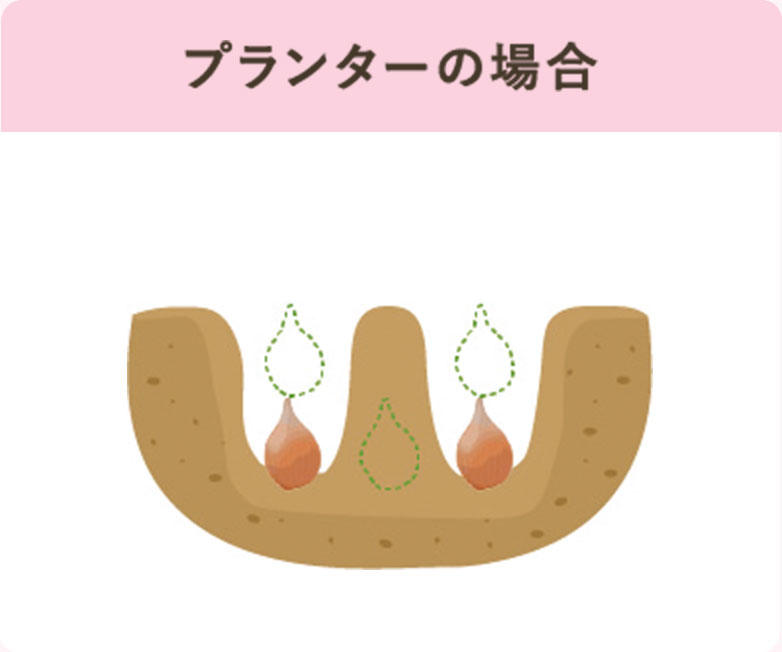 プランターの場合